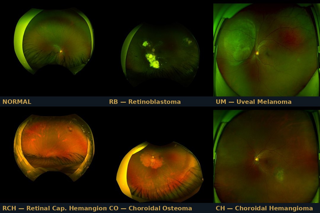 AEGIS OcuGuard — fundus image grid showing six intraocular disease classes